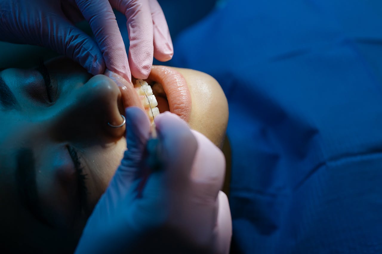 Close-up Photo of Dentist Examining Patient's Teeth